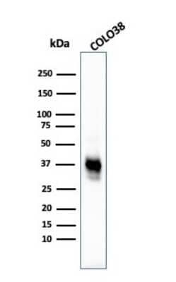 Western Blot: Melanoma Marker (MART-1 + Tyrosinase + gp100) Antibody (M2-7C10 + M2-9E3 + T311 + HMB45) [NBP2-34337]