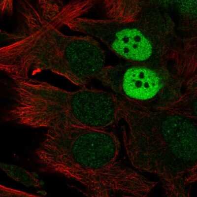 Immunocytochemistry/ Immunofluorescence: Melanoma antigen family C2 Antibody [NBP2-34145]