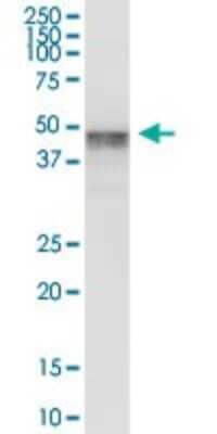 Western Blot: Melanoma antigen family C2 Antibody [H00051438-B01P]