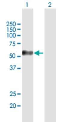 Western Blot: Melanoma antigen family C2 Antibody [H00051438-B01P]
