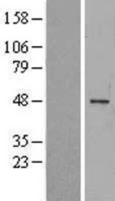 Western Blot: Melanoma antigen family C2 Overexpression Lysate [NBL1-12813]