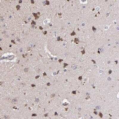 Immunohistochemistry-Paraffin: Melanoma antigen family E1 Antibody [NBP1-88031]