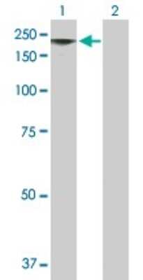 Western Blot: Melanoma antigen family E1 Antibody [H00057692-B02P]