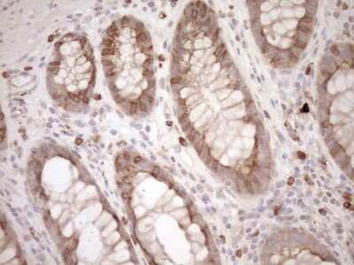 Immunohistochemistry: Melanophilin Antibody (OTI6E8) [NBP2-45883]