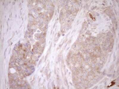 Immunohistochemistry: Melanophilin Antibody (OTI6E8) [NBP2-45883]