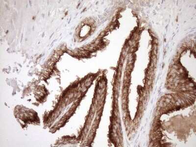 Immunohistochemistry: Melanophilin Antibody (OTI6E8) [NBP2-45883]