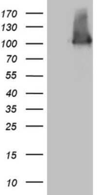 Western Blot: Melanophilin Antibody (OTI6E8) [NBP2-45883]