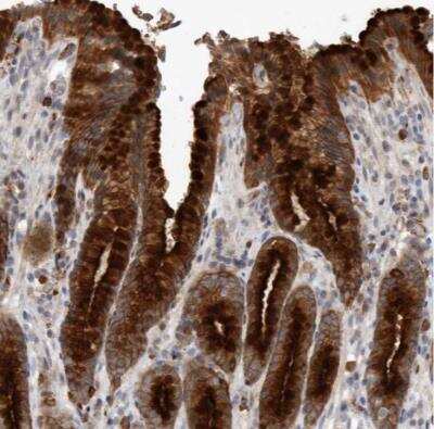 Immunohistochemistry-Paraffin: Melanophilin Antibody [NBP1-84765]