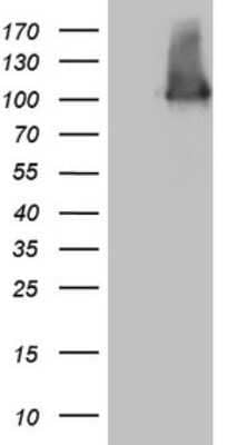 Western Blot: Melanophilin Antibody (OTI6E8)Azide and BSA Free [NBP2-72649]