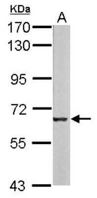 Western Blot: Melanophilin Antibody [NBP2-17274]