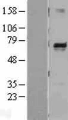 Western Blot: Melanophilin Overexpression Lysate [NBL1-13139]