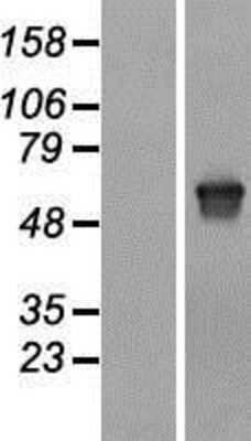 Western Blot: Melanophilin Overexpression Lysate [NBL1-13140]