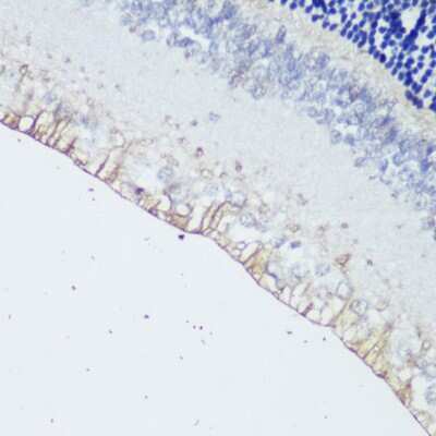 Immunohistochemistry-Paraffin: Melanopsin Antibody - Azide and BSA Free [NBP3-03697]