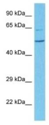 Western Blot: Melanopsin Antibody [NBP3-10119]