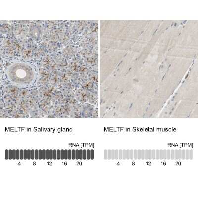 Immunohistochemistry-Paraffin: Melanotransferrin/CD228/MFI2 Antibody [NBP1-85777]