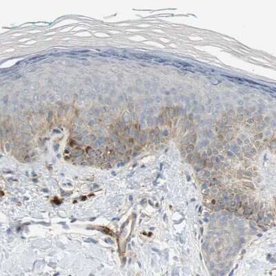 Immunohistochemistry-Paraffin: Melanotransferrin/CD228/MFI2 Antibody [NBP1-85777]