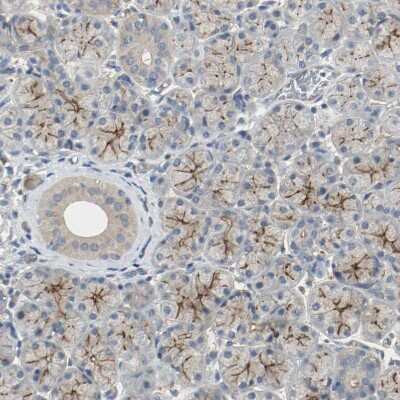 Immunohistochemistry-Paraffin: Melanotransferrin/CD228/MFI2 Antibody [NBP1-85777]