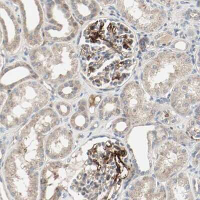 Immunohistochemistry-Paraffin: Melanotransferrin/CD228/MFI2 Antibody [NBP1-85777]