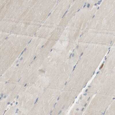 Immunohistochemistry-Paraffin: Melanotransferrin/CD228/MFI2 Antibody [NBP1-85777]