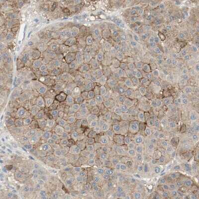 Immunohistochemistry-Paraffin: Melanotransferrin/CD228/MFI2 Antibody [NBP1-85777]