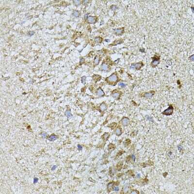 Immunohistochemistry-Paraffin: Melatonin R1A/MT1/MTNR1A Antibody - Azide and BSA Free [NBP3-03633]