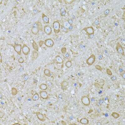 Immunohistochemistry-Paraffin: Melatonin R1A/MT1/MTNR1A Antibody - Azide and BSA Free [NBP3-03633]