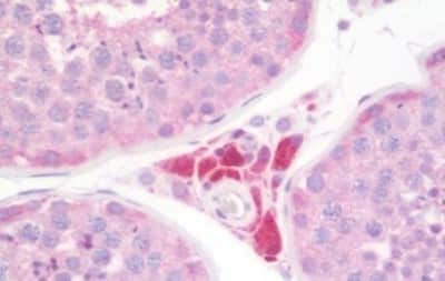 Immunohistochemistry-Paraffin: Melatonin R1A/MT1/MTNR1A Antibody [NBP3-14399]