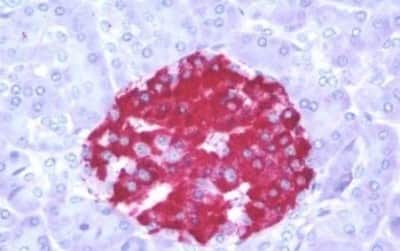 Immunohistochemistry-Paraffin: Melatonin R1A/MT1/MTNR1A Antibody [NBP3-14399]