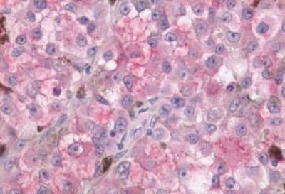 Immunohistochemistry-Paraffin: Melatonin R1A/MT1/MTNR1A Antibody [NBP3-14399]