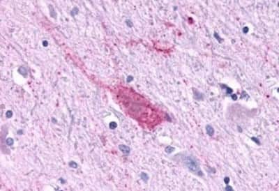 Immunohistochemistry-Paraffin: Melatonin R1A/MT1/MTNR1A Antibody [NBP3-14399]