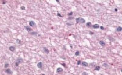 Immunohistochemistry-Paraffin: Melatonin R1A/MT1/MTNR1A Antibody [NBP3-14400]