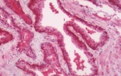 Immunohistochemistry-Paraffin: Melatonin R1A/MT1/MTNR1A Antibody [NBP3-14400]