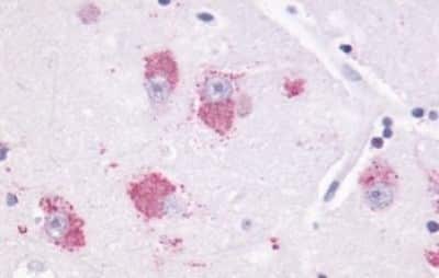 Immunohistochemistry-Paraffin: Melatonin R1A/MT1/MTNR1A Antibody [NBP3-14400]