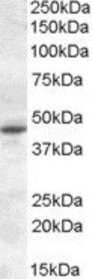 Western Blot: Melatonin R1A/MT1/MTNR1A Antibody [NBP1-28912]