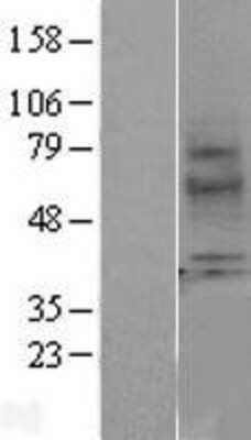 Western Blot: Melatonin R1A/MT1/MTNR1A Overexpression Lysate [NBL1-13378]