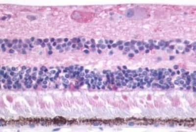 Immunohistochemistry: Melatonin Receptor 1B Antibody [NBP3-14401]