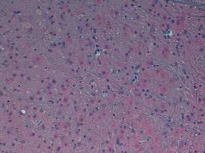 Immunohistochemistry: Melatonin Receptor 1B Antibody - BSA Free [NLS932]