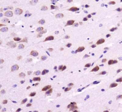 Immunohistochemistry: Melatonin Receptor 1B Antibody - BSA Free [NLS932]