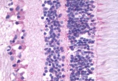 Immunohistochemistry-Paraffin: Melatonin Receptor 1B Antibody [NBP3-14401]