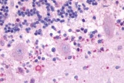 Immunohistochemistry-Paraffin: Melatonin Receptor 1B Antibody [NBP3-14401]