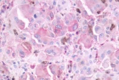 Immunohistochemistry-Paraffin: Melatonin Receptor 1B Antibody [NBP3-14401]