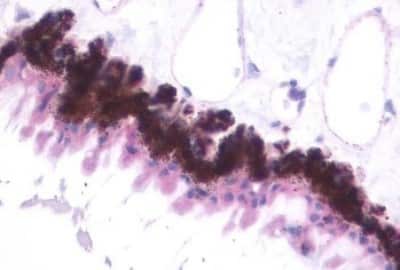 Immunohistochemistry-Paraffin: Melatonin Receptor 1B Antibody [NBP3-14401]