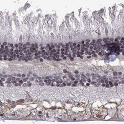 Immunohistochemistry-Paraffin: Melatonin Receptor 1B Antibody [NBP3-17202]