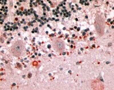 Immunohistochemistry-Paraffin: Melatonin Receptor 1B Antibody - BSA Free [NLS932]