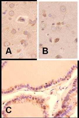 Immunohistochemistry-Paraffin: Melatonin Receptor 1B Antibody - BSA Free [NLS932]