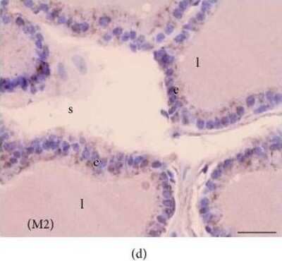 Immunohistochemistry-Paraffin: Melatonin Receptor 1B Antibody - BSA Free [NLS932]
