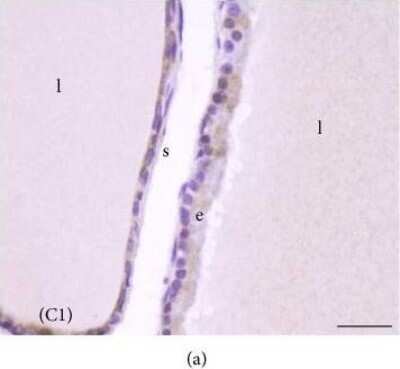 Immunohistochemistry-Paraffin: Melatonin Receptor 1B Antibody - BSA Free [NLS932]