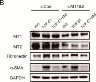 Knockdown Validated: Melatonin Receptor 1B Antibody - BSA Free [NLS932]