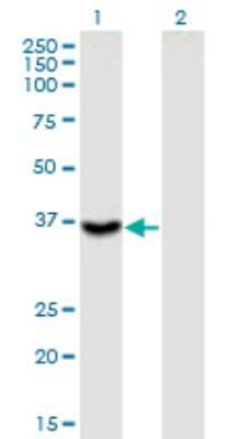 Western Blot: Melusin/ITGB1BP2 Antibody (3G9) [H00026548-M02]