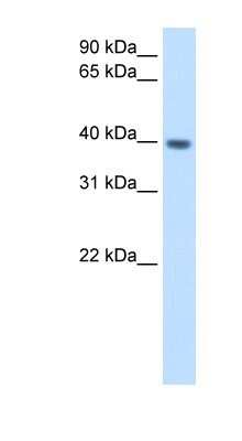 Western Blot: Melusin/ITGB1BP2 Antibody [NBP1-55149]